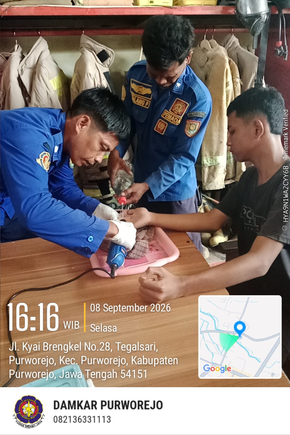 EVAKUASI CINCIN DI JARI WARGA YANG TIDAK BISA DI LEPAS